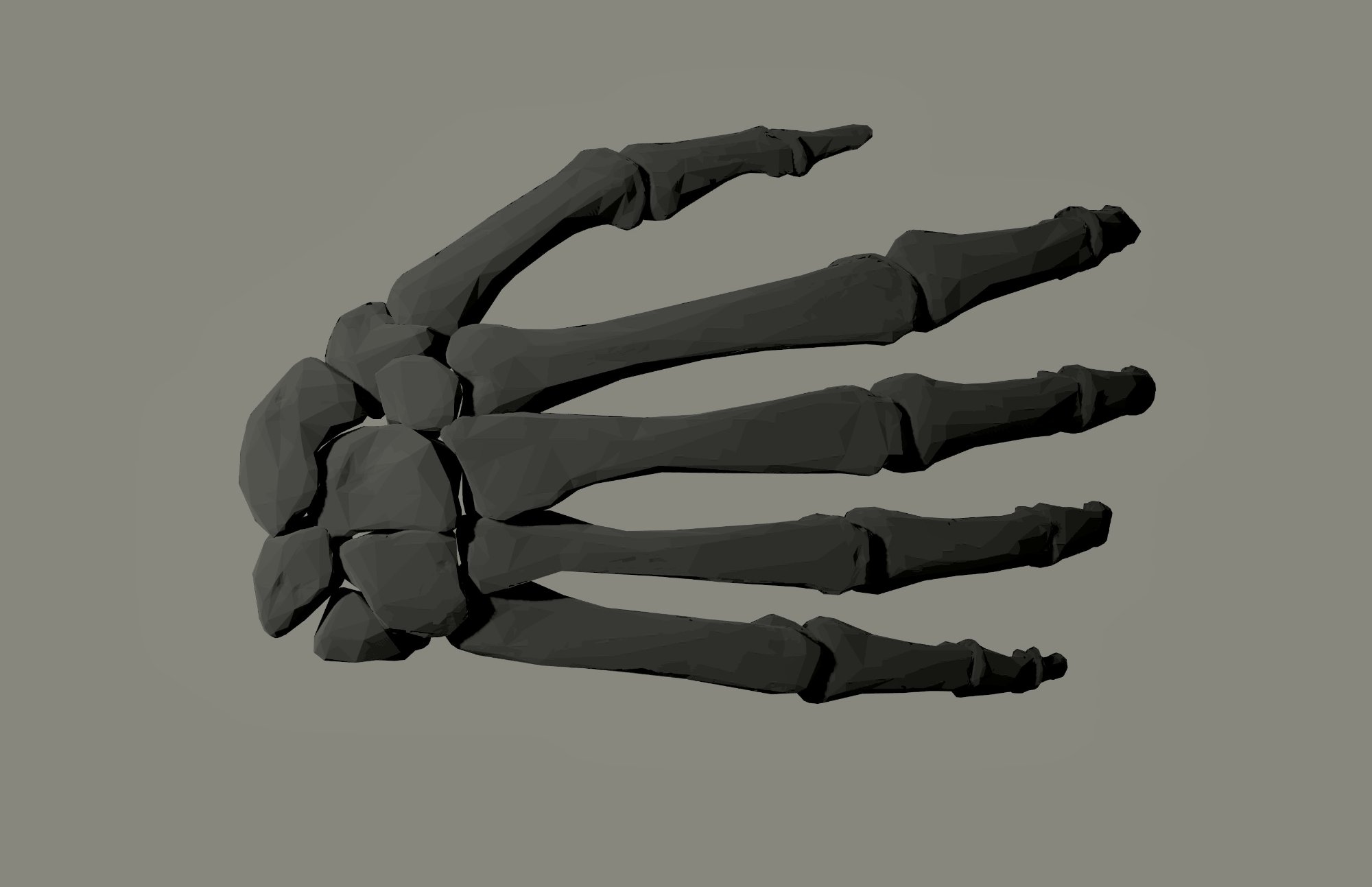 3D bone scan